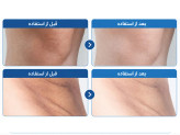 اسپری لایهبردار و روشن کننده صورت و بدن ترانزامیک اسید پیل شات (PS) دکتر ملاکسین