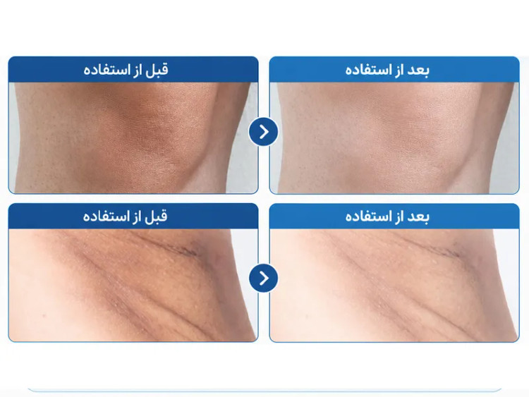 اسپری لایهبردار و روشن کننده صورت و بدن ترانزامیک اسید پیل شات (PS) دکتر ملاکسین