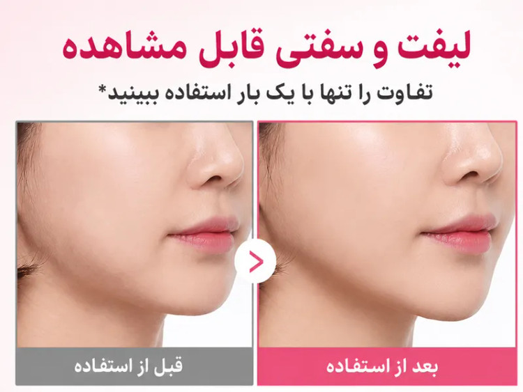کرم ضد چروک گردن کلاژن PDRN گواشا مدی کیوب(اورجینال)