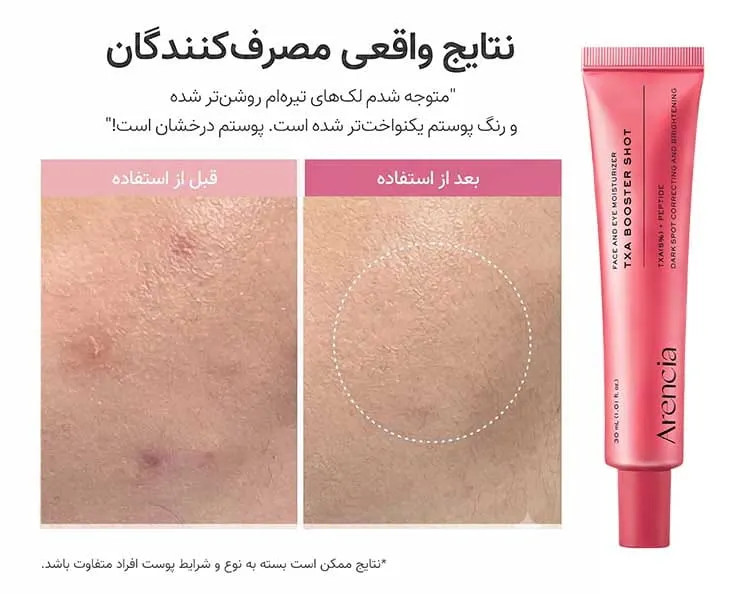 بوستر شات دور چشم و صورت TXA آرنسیا اصل (ضد لک و روشن کننده قوی)