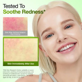 سرم تسکین دهنده ضد قرمزی آزلائیک اسید 10% و هیالورون آنوا (نسخه نتفلیکس) 50 میل